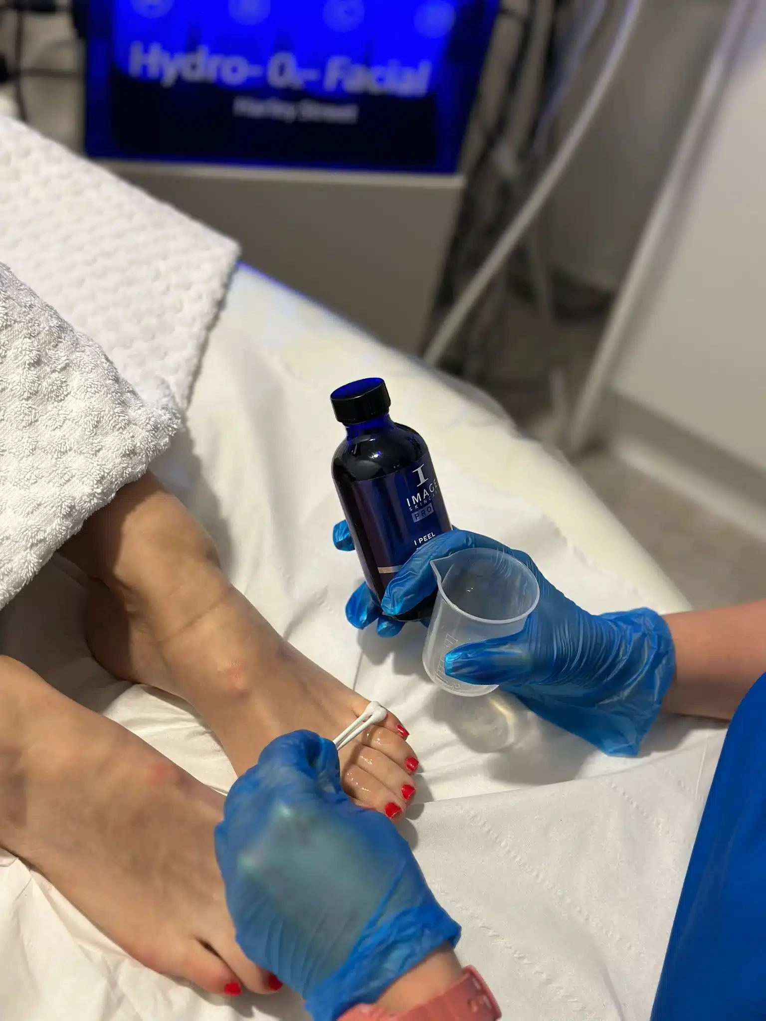Dark Underarms and Feet Treatment Dark Underarms and Feet Treatment Treatment for pigmentation on the toes