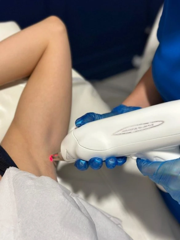 Treatments available for dark skin on the under arm Dark Underarms and Feet Treatments available for dark skin on the under arm