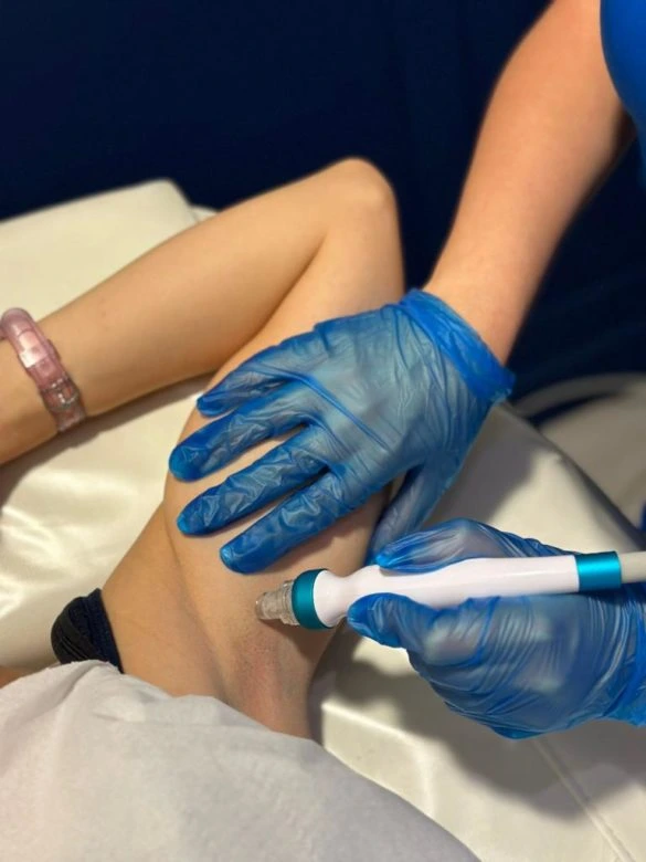 Treatments available for dark skin on the under arm Treatments available for dark skin on the under arm